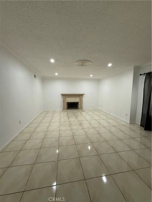 Empty room, Fireplace, Interior, Recessed Lighting
