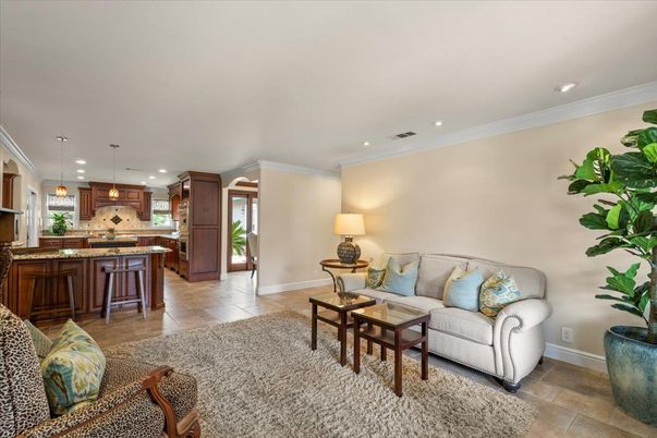 Fireplace, Interior, Living room, Recessed Lighting