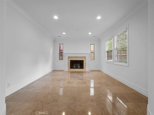 Empty room, Fireplace, Interior, Recessed Lighting